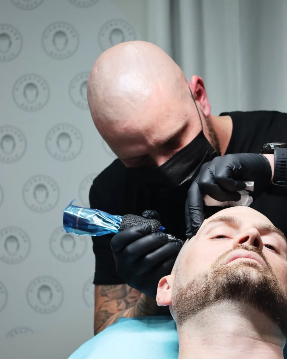 Michael applying scalp micropigmentation at Signature Scalp, Marden