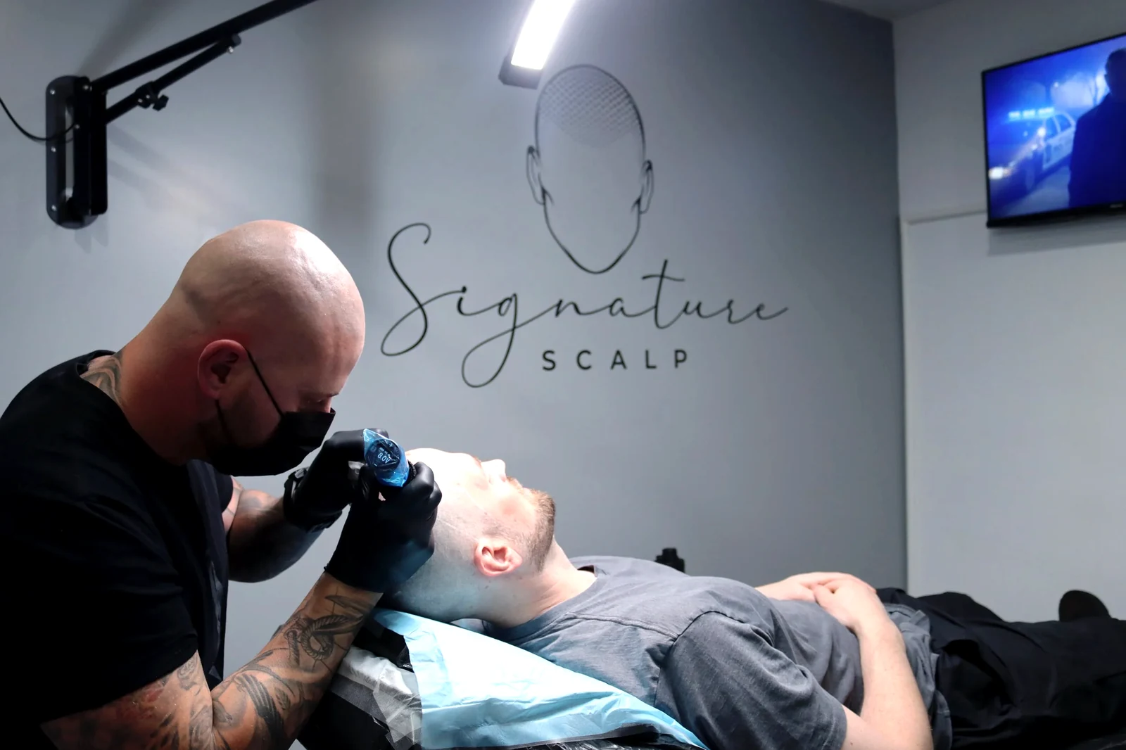 A scalp micropigmentation session at the Signature Scalp studio in Marden